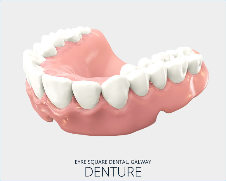 Removable Denture 